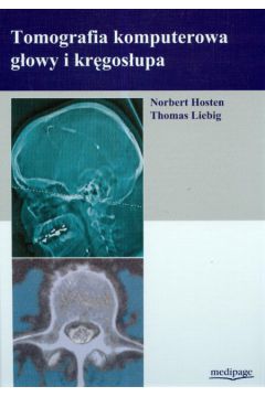 Tomografia komputerowa gowy i krgosupa - Hosten Norbert, Liebig Thomas