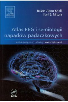 Atlas EEG i semiologii napadw padaczkowych
