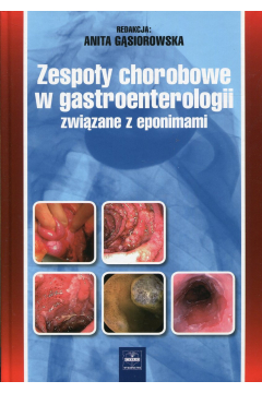Zespoy chorobowe w gastroenterologii zwizane z eponimami