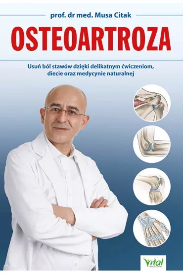 Osteoartroza - Musa Citak