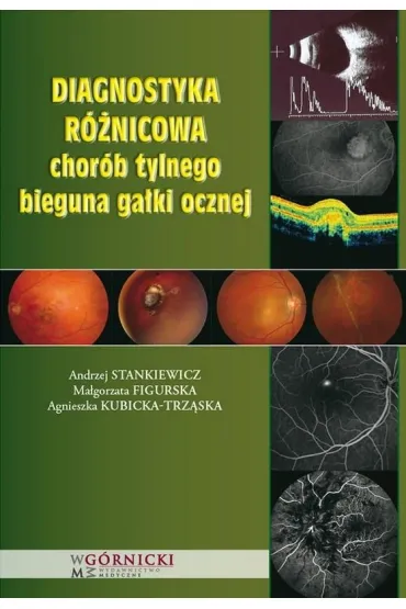 Diagnostyka r�nicowa chor�b tylnego bieguna ga�ki ocznej - Andrzej Stankiewicz, Ma�gorzata Figurska, Agnieszka Kubicka-Trz�ska