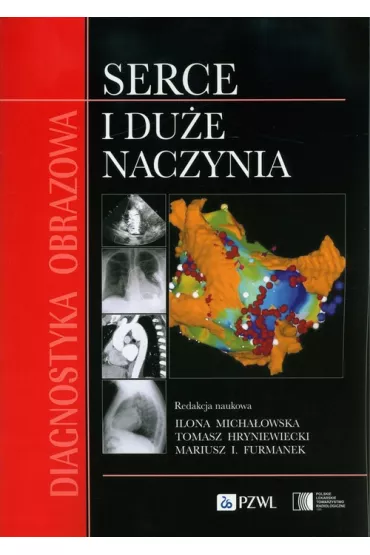 Diagnostyka obrazowa Serce i du�e naczynia - Ilona Micha�owska, Tomasz Hryniewiecki, Mariusz I. Furmanek