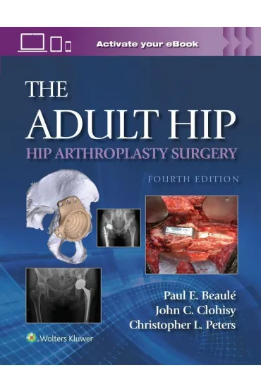 The Adult Hip: Hip Arthroplasty Surgery Print + eBook with Multimedia - Paul E Beaule