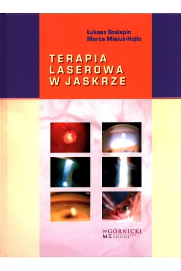 Terapia laserowa w jaskrze - Marta Misiuk-Hoj�o, �ukasz  Szelepin