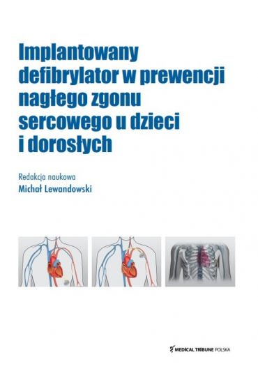 Implantowany defibrylator w prewencji nagłego zgonu sercowego u dzieci i dorosłych