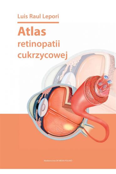 Atlas retinopatii cukrzycowej