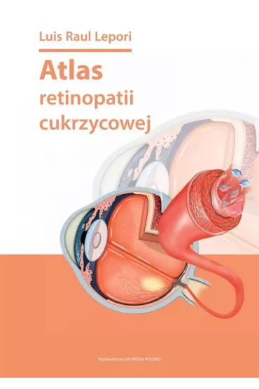 Atlas retinopatii cukrzycowej - Luis Raul Lepori