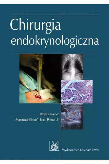 Chirurgia endokrynologiczna - Stanis�aw Cicho�, Lech  Pomorski