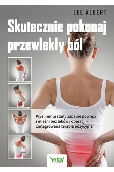 Skutecznie pokonaj przewlek�y b�l. Wyeliminuj stany zapalne powi�zi i mi�ni bez lek�w i operacji – zintegrowana terapia pozycyjna - Lee Albert