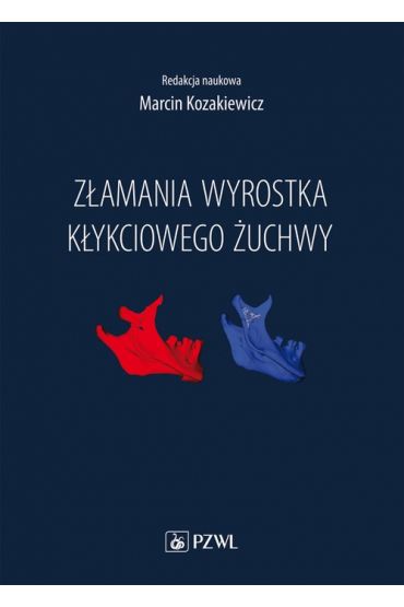 Złamania wyrostka kłykciowego żuchwy