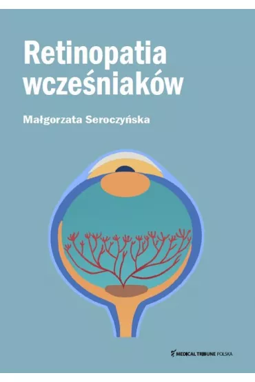 Retinopatia wczeniakw - Magorzata  Seroczyska