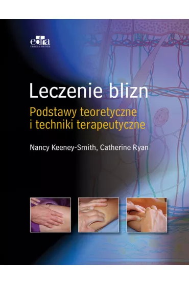 Leczenie blizn pourazowych - Ryan Cathy, Smith Nancy  Keeney