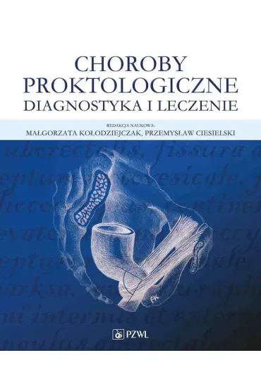 Choroby proktologiczne. Diagnostyka i leczenie - Ma�gorzata Ko�odziejczak, Przemys�aw  Ciesielski