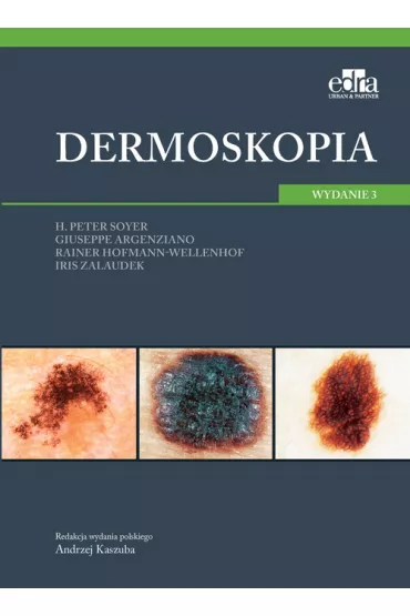 Dermoskopia - Rainer Hofmann-Wellenhof, Iris Zalaudek, Giuseppe Argenziano, H. Peter Soyer