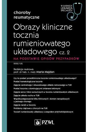 Obrazy kliniczne tocznia rumieniowatego układowego. Część 2. Na podstawie opisów przypadków. Choroby reumatyczne. W gabinecie lekarza specjalisty