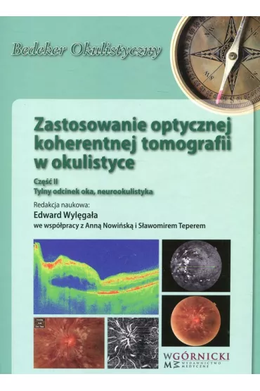 Zastosowanie optycznej koherentnej tomografii w okulistyce. Cz�� 2 - Edward Wyl�ga�a