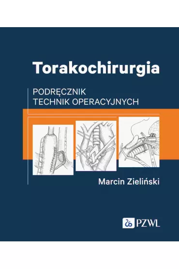 Torakochirurgia - Marcin Zieli�ski