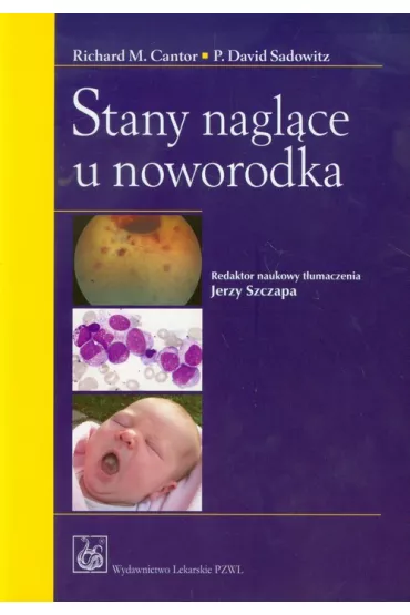 Stany nagl�ce u noworodka - Richard M. Cantor, Dawid P. Sadowitz