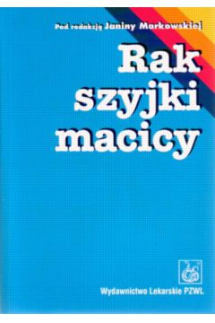 Rak szyjki macicy - Markowska Janina i inni - Markowska Janina i inni