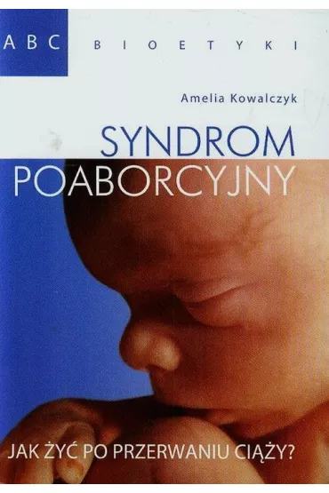 Syndrom poaborcyjny Jak �y� po przerwaniu ci��y? - Amelia Kowalczyk