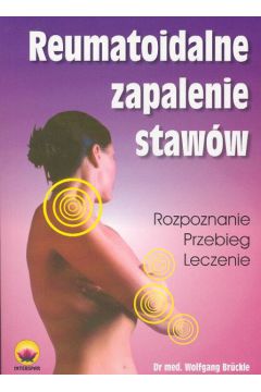 Reumatoidalne zapalenie staw�w - Bruckle Wolfgang - Wolfgang Bruckle
