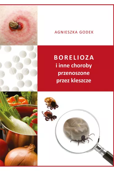 Borelioza i inne choroby przenoszone przez kleszcze - Agnieszka Godek
