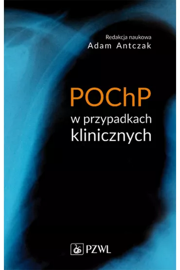 POChP w przypadkach klinicznych - Adam Antczak