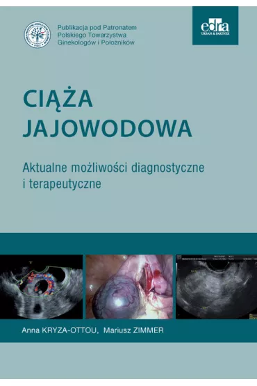 Ci��a jajowodowa. Aktualne mo�liwo�ci diagnostyczne i terapeutyczne - M. Zimmer, A Kryza-Ottou