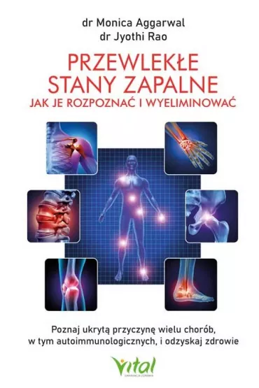 Przewlek�e stany zapalne. Jak je rozpozna� i wyeliminowa� - Jyothi Rao, Monica Aggarwal