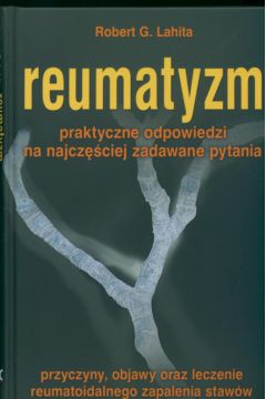 Reumatyzm Praktyczne odpowiedzi na najcz�ciej zadawane pytania - Lahita Robert G. - Robert G. Lahita