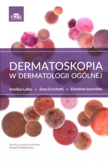 Dermatoskopia w dermatologii og�lnej - Aimilios Lallas, Dimitrios Ioannides, Enzo Errichetti