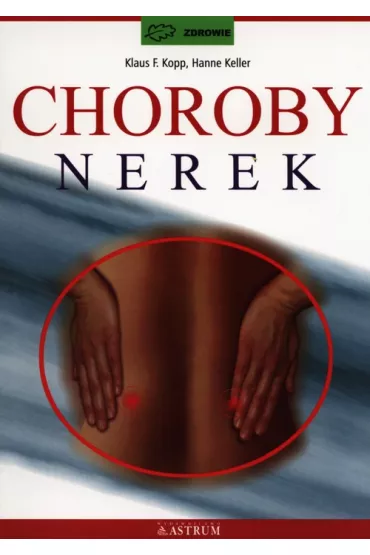 Choroby nerek - Klaus F. Kopp, Hanne Keller