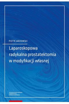 eBook Laparoskopowa radykalna prostatektomia w modyfikacji wasnej pdf