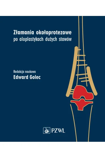 Z�amania oko�oprotezowe po aloplastykach du�ych staw�w - Edward  Golec