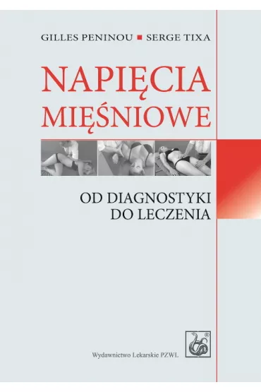 Napi�cia mi�niowe. Od diagnostyki do leczenia - Peninou Gilles, Serge Tixa