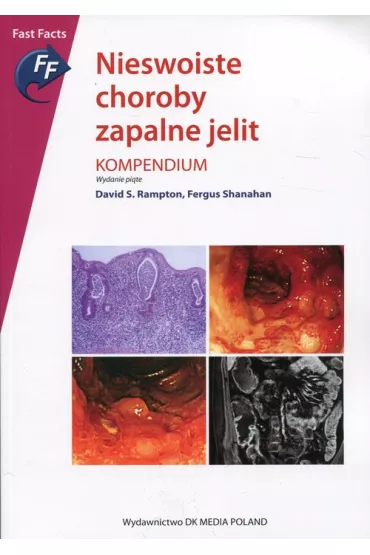 Nieswoiste choroby zapalne jelit. Kompendium - Fergus Shanahan, David S Rampton