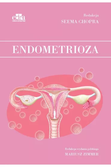 Endometrioza - S Chopra