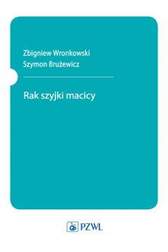 eBook Rak szyjki macicy pdf mobi epub