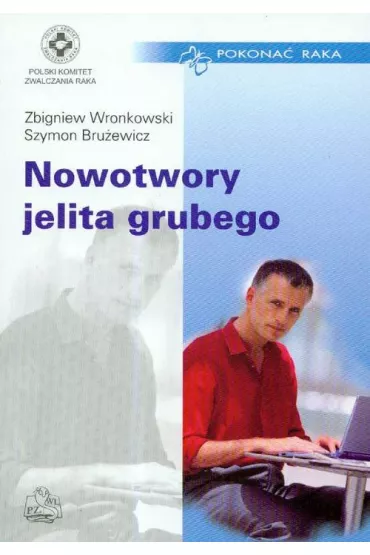 Nowotwory jelita grubego - Szymon Bru�ewicz, Zbigniew Wronkowski