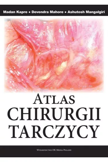 Atlas chirurgii tarczycy - Ashutosh Mangalgiri, Devendra Mahore, Madam Kapre
