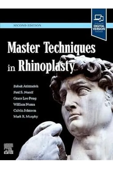 Master Techniques in Rhinoplasty
