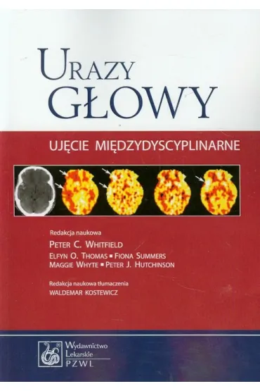 Urazy g�owy. Uj�cie mi�dzydyscyplinarne