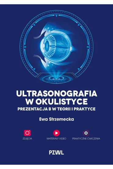 Ultrasonografia w okulistyce. Prezentacja B w teorii i praktyce - Ewa  Strzemecka