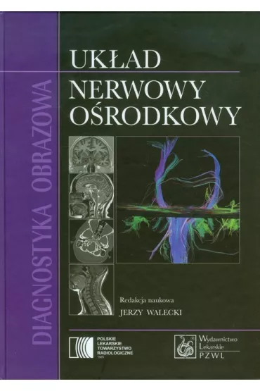 Diagnostyka obrazowa Uk�ad nerwowy o�rodkowy