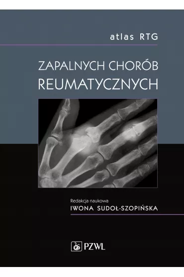 Atlas RTG zapalnych chor�b reumatycznych - Iwona Sudo�-Szopi�ska