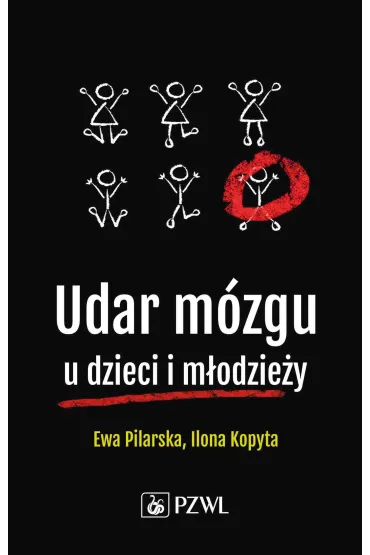 Udar m�zgu u dzieci i m�odzie�y - Ewa  Pilarska, Edyta  Szurowska, Ilona  Kopyta, Robert  Sabiniewicz
