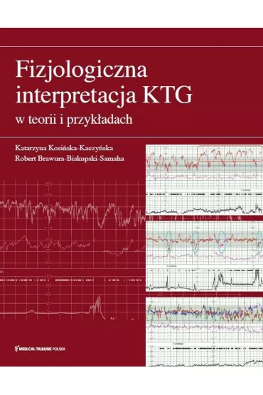 Fizjologiczna interpretacja KTG w teorii i przykadach - Robert Brawura-Biskupski-Samaha, Katarzyna Kosiska-Kaczyska