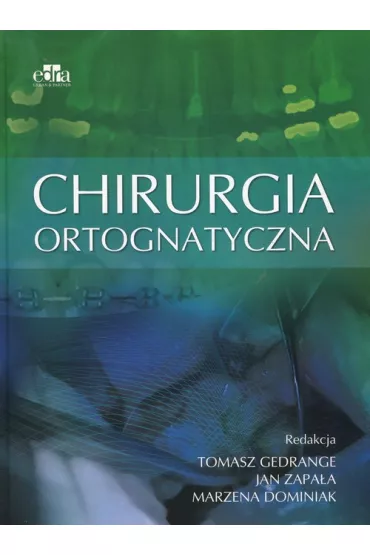 Chirurgia ortognatyczna