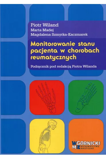 Monitorowanie stanu pacjenta w chorobach reumatycznych - Piotr Wiland, Marta Madej, Magdalena Szmyrka-Kaczmarek