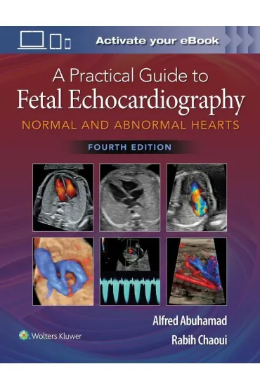 A Practical Guide to Fetal Echocardiography - Alfred Z Abuhamad